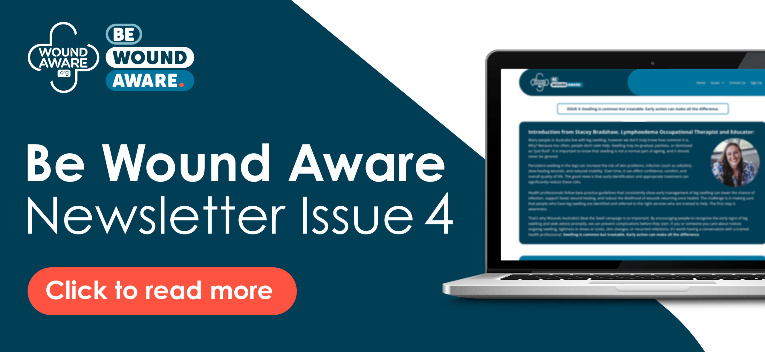 Be Wound Aware_Newsletter Issue 4